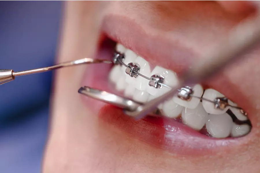 dentists-check-the-teeth-and-braces-the-patients-i-2026-01-07-00-11-44-utc.webp